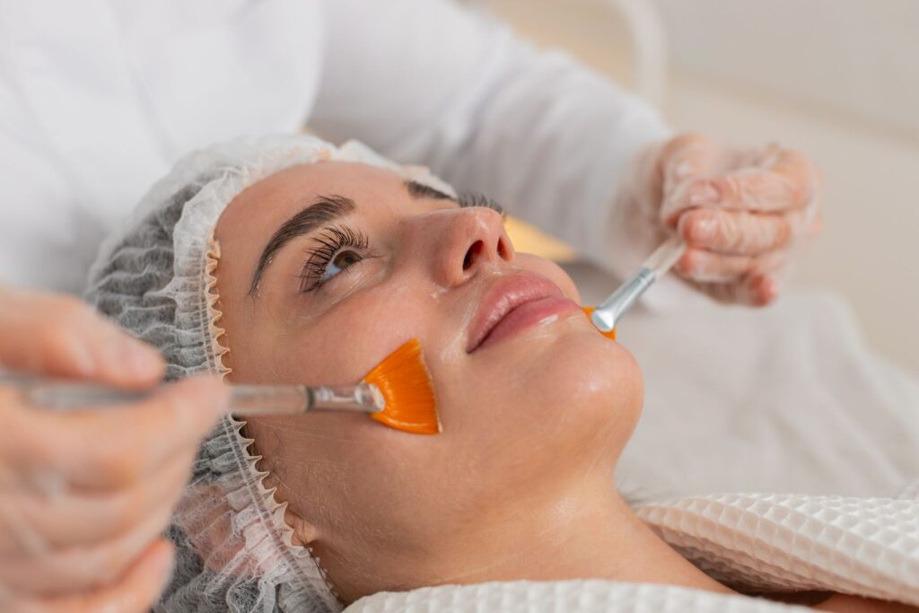 chemical peels
