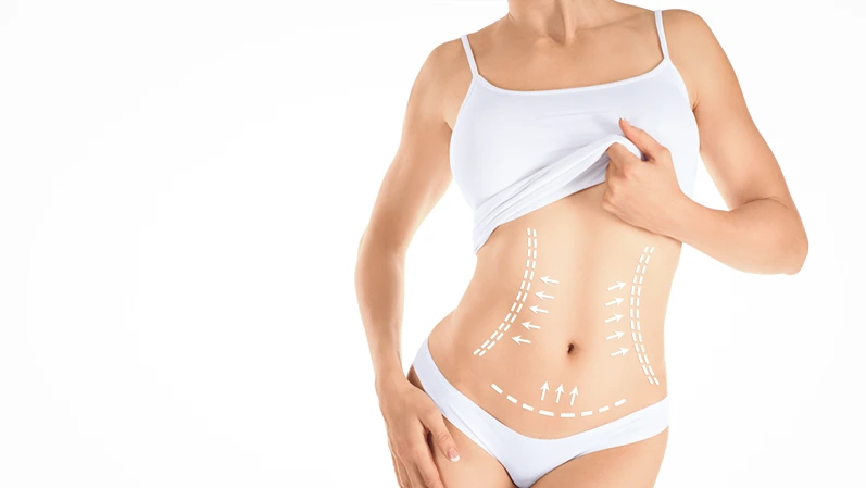 Fit female torso in white underwear with markup by arrows on her stomach, isolated on white. Aesthetic medicine, plastic surgery, tummy tuck, abdominoplasty, liposuction, postpartum body restoration.